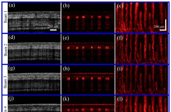 Vol. 25, No. 7 3 Apr 2017 OPTICS EXPRESS 7773 Fig. 10. Multi-beam speckle variance images of the nailfold obtained by interframe SVOCT between adjacent frames.