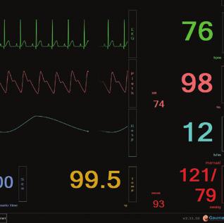and other details Get real-time feedback on the quality of compressions and