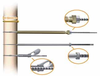 Locking Screw Measurement There are three (3) methods: 1. Gold 9.0mm Drill Sleeve, silver 4.0mm Drill Sleeve and 4.0mm Long Pilot Drill* 2. Screw Depth Gauge (7163-1189) 3.