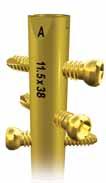 0mm Long Pilot Drill* 1 2 3 Locking Screw Insertion Distal locking options include three (3) statically locked threaded holes that are targeted through the orange and green color-coded holes on the