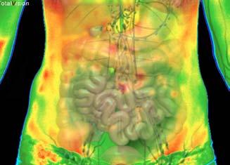 In contrast to X-ray equipment and invasive diagnostics, such as a PET scan, the infrared screening system allows pathophysiological abnormalities to be displayed, in a non-invasive way, in the form