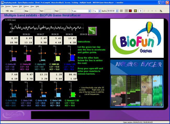 Open Display 1 EEG Screens: Multiple Bands Training - Multiple bands - BIOFUN Game NeuroRacer - 1 monitor: Let the middle bar rise over the line to accelerate and gather points.