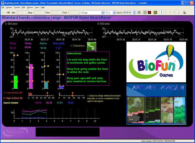 Training - Std bands coherence - BIOFUN Game NeuroRacer - 1 monitor: Let the middle bar stay between the lines to accelerate and gather points.