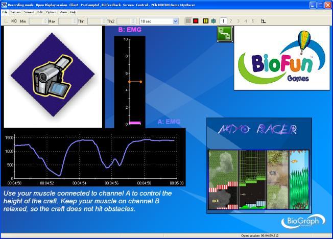 SEMG Biofeedback - Control CTRL - Control with BIOFUN Game MyoRacer and 3 EMG (Screen: Control - 3Ch BIOFUN Game MyoRacer) Before starting the game, adjust the scale of the line graph to the client's