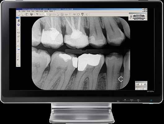 Intuitive software, simple image sharing Whether used as a standalone program or integrated with your practice s