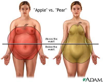 Definitie Obezitatea o conditie de acumulare anormala sau excesiva a tesutului adipos Persoanele difera nu doar dupa gradul de exces ponderal avut, dar si prin distributia