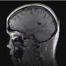 Examples 1. Brain MRI 2.