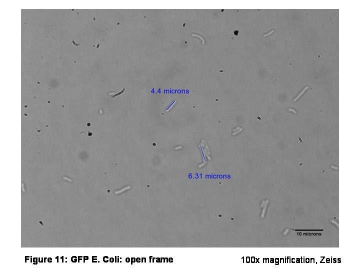 Microbes: How small are we really talking about?the E. coli cells measured here are: 4.4uM 6.