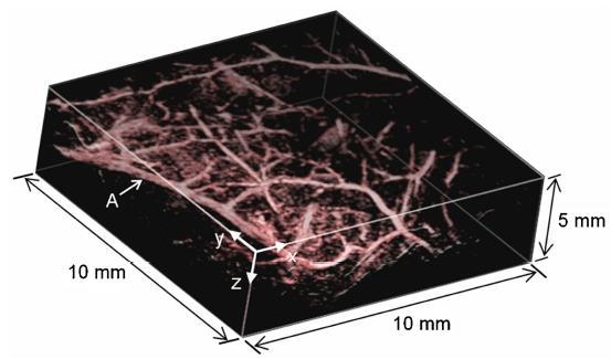 Examples of applications: vascularization imaging Optical detection with a Fabry-Perot Light wavelength : 670 nm Ultrasound frequency : 0