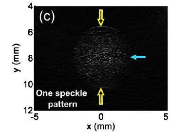 Enhanced photoacoustic imaging with