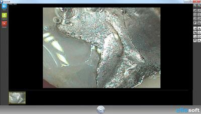 Captured Images Taking Intraoral Camera Images Automatically This