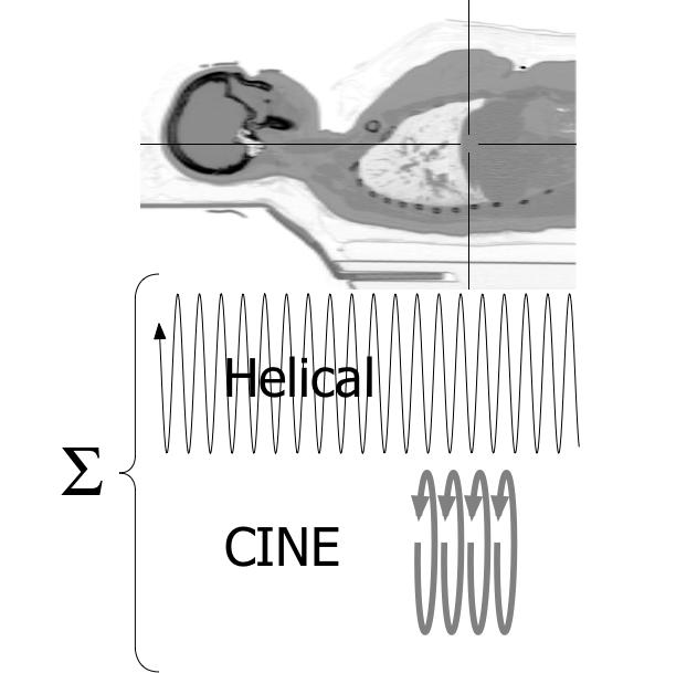 Helical+CINE CTAC Acquisition to Compensating For Patient Motion 1. Standard non contrast helical CT (diagnostic beam) for both CT imaging correlation and for CTbased attenuation correction (CTAC) 2.