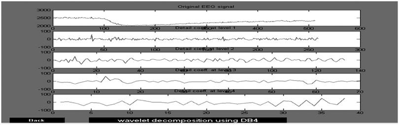 1 0 International Journal of Electronics Engineering Fig. 7: The Wavelet Decomposition for Channel-2 Using DB-4 Wavelets Fig.
