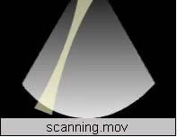 Echo imaging Radar Sonar Medical Ultrasound Non-destructive testing