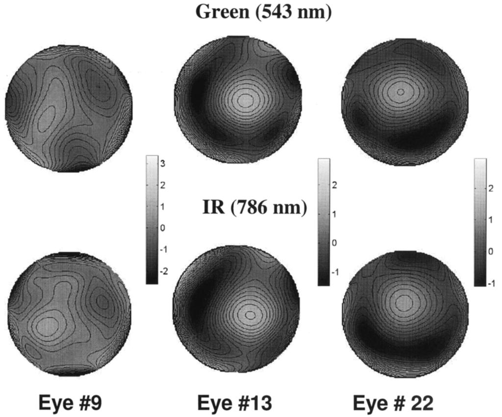 30 Aberrations of the Eye in Visible and Near Infrared Illumination Llorente et al. and second-order terms have been cancelled to allow a higherresolution view of higher-order terms.