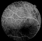 area of view (disc and macula). An indicator of the instrument s image quality is the visibility of macular vessels and vessel crossing.