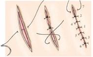 Available products are sutures, vascular grafts, artificial ligaments, artificial joints, scaffolds