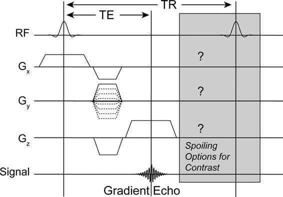 Rapid Gradient-Echo Imaging 1301 Figure 1. Gradient-echo sequences generally consist of repeated RF pulses with a spacing TR, and imaging gradients.