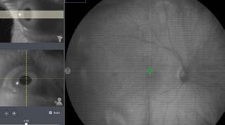 facilitating a more Swivel motion: The ability to swivel the device between the right and left eye helps technicians capture a high quality image without realigning the patient.