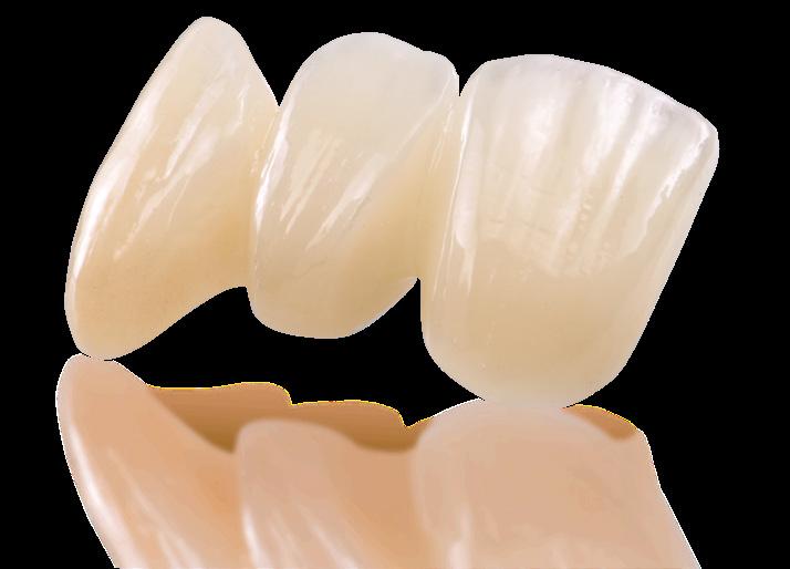 ZirCAD A natural gradient of chroma and translucency