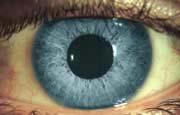 hyperopia h. glaucoma m.
