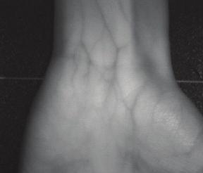 NIR images of hand vein of four different parts, dorsal hand, palm, wrist, and finger vein.