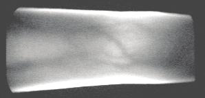 The FIR method is often used in hand-dorsa vein imaging, and NIR method can be used in all veins imaging in hand.