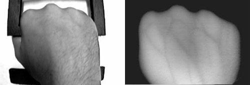 The reduced hemoglobin in venous blood absorbs more of the incident IR radiation than the surrounding tissue thus appearing darker when viewed on a conventional PC monitor. Fig.2.