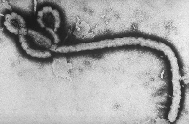 Ebola virus Electrons