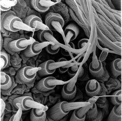 Electron Microscope Images http://blog.