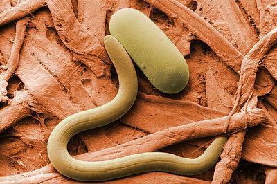 Electron Microscope Images Trichinosis spiralis (microscopic animal