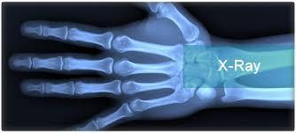EM Radiation: X rays Uses: Shadow pictures of luggage and inside the human body. Dangers: High doses can kill cells. Lower doses can cause cells to become cancerous.