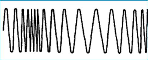 waves, microwaves or down electrical wires Sent as pulses in optical fibres or electrical wires Signals suffer from noise which gets worse