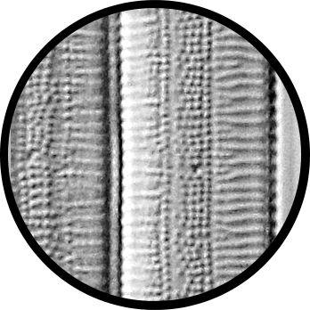 clearly visible Suggested techniques to improve resolution: oblique illumination, Dark Field, Differential interference contrast, Phase Contrast Diatom Number 5 Species: Eunotia