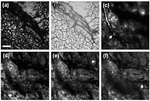 Joo et al. Page 8 Figure 4. (a) (b): Images on a fixed rat retina tissue recorded with Si-PD based ACM and Ge-PD based linear detection, respectively.