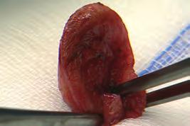 operation No interfering bleeding Preservation of tissue tautness
