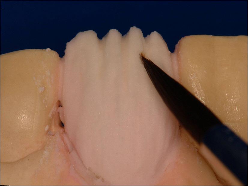 Build to full contour with DENTIN Cut back the incisal by 1/3 and add the appropriate ENAMEL overbuilding by approx 10% Opaceous Dentin