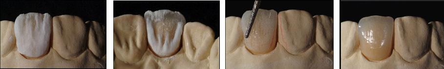 Contouring and Glazing. If a correction firing is necessary, add the appropriate materials to re-contour the restoration and repeat Dentin / Enamel firing, reducing the firing temperature to 940 C.