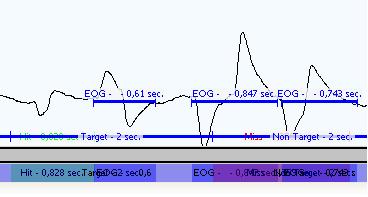 The EOG that results from looking at the start button and looking back to the central object again can be used for calibration of an EOG detection algorithm.