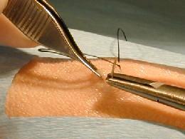 After releasing the needle, the right hand is pronated before the needle is regrasped.