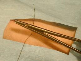 The suture material is drawn through the skin, leaving 2-3 cm. protruding from the far skin surface.
