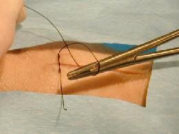 needle holder pointed to the left as the long strand is wrapped