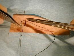 The first "near-near" component is placed by reversing the placement of the needle in the needle holder and "backhanding" the needle