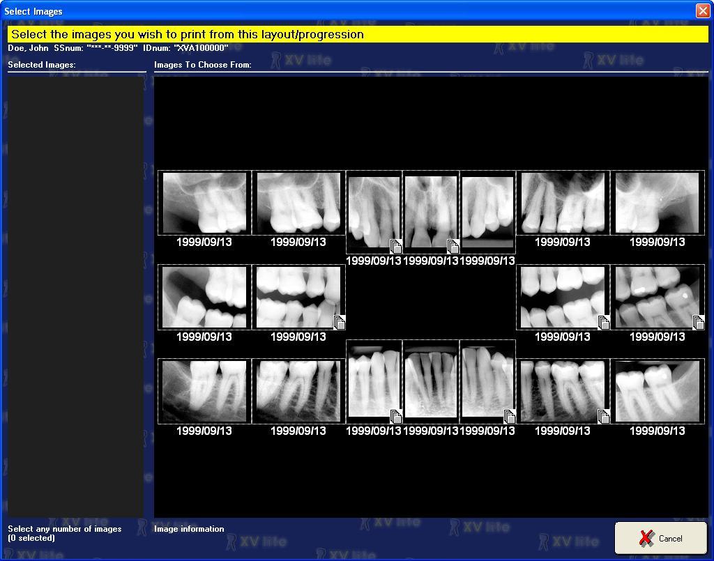 a. The Images To Chose From section on the right displays the current images in the patient s record. Click on each desired image to add to the print job. b.