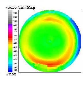 5mm Average of n = 30 post-op maps Optical Zone = 6.