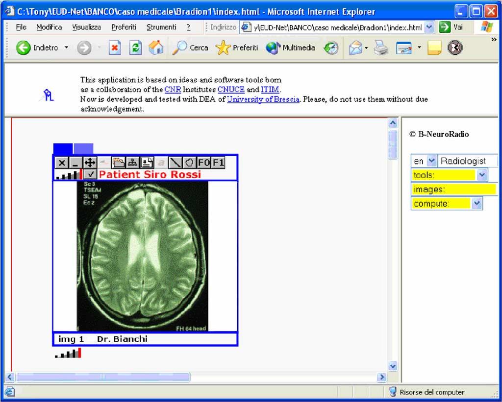 COSTABILE et al.: VISUAL INTERACTIVE SYSTEMS FOR END-USER DEVELOPMENT 1031 Fig. 1. Web page with the first prototype of the B-NeuroRadio software environment supporting neuroradiologists.
