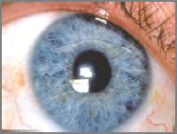 Patient had Phakic IOLs 10 years ago Endothelial Cell Anterior chamber depth Importance of Yearly Eye Exams!