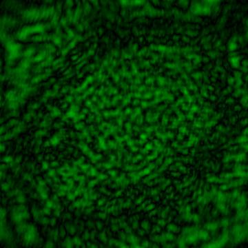 (b) Onion cells 1 - with aperture, OBJ 0.15 V/p, REF.25 V/p Fig.