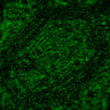 (d) Onion cells 1 - with aperture, OBJ 0.12 V/p, REF 0.23 V/p, 1 Z = Z 2 min Fig.