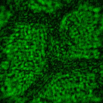 (c) Onion cells 2 - with aperture, OBJ.04 V/p, REF.07 V/p Fig.